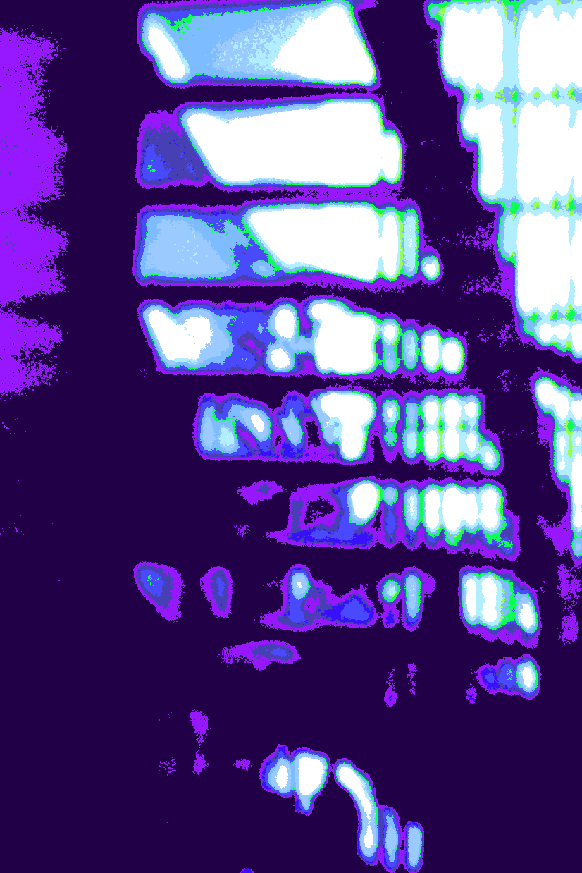 "Treppe" © Josi Bennöhr